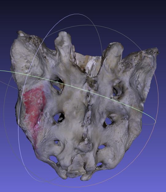 3D model of a sacrum