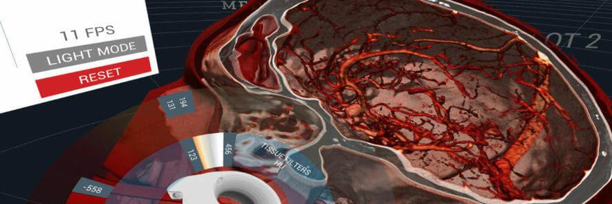 DICOM_VIEWER_MEDICALHOLODECK_03
