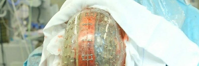 skull