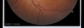 eyeswipe2