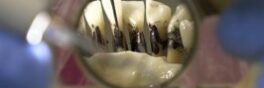 ultrasonicteeth3